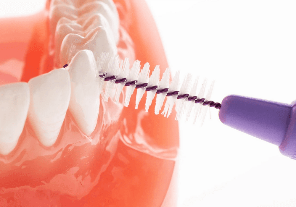 TePe ORIGINAL 6 mezizubní kartáčky 1,1 mm, 25ks - náhled 2