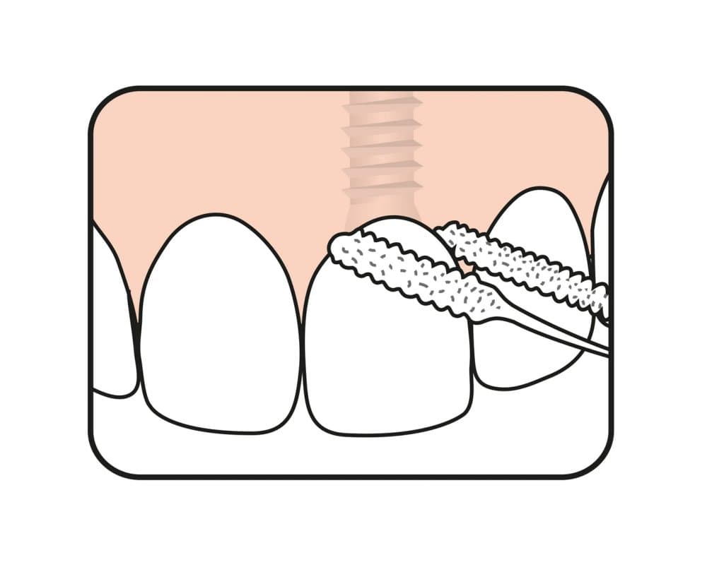 TePe Bridge & Implant Floss zubní nit, 30ks - náhled 2