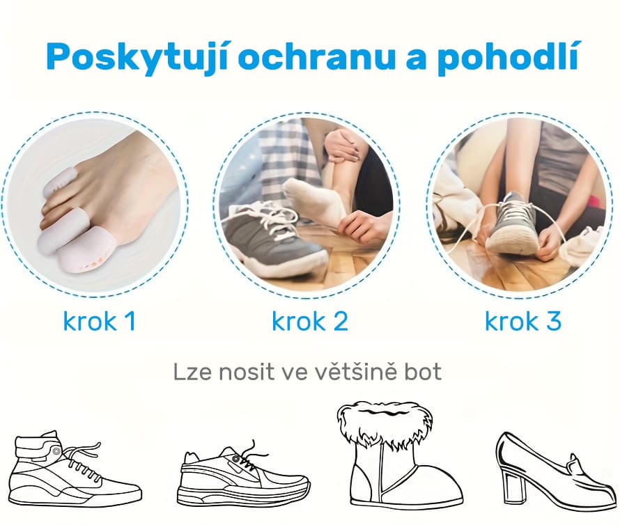 Ochranné silikonové návleky na prsty (3 velikosti, bílé), 6 ks - náhled 3
